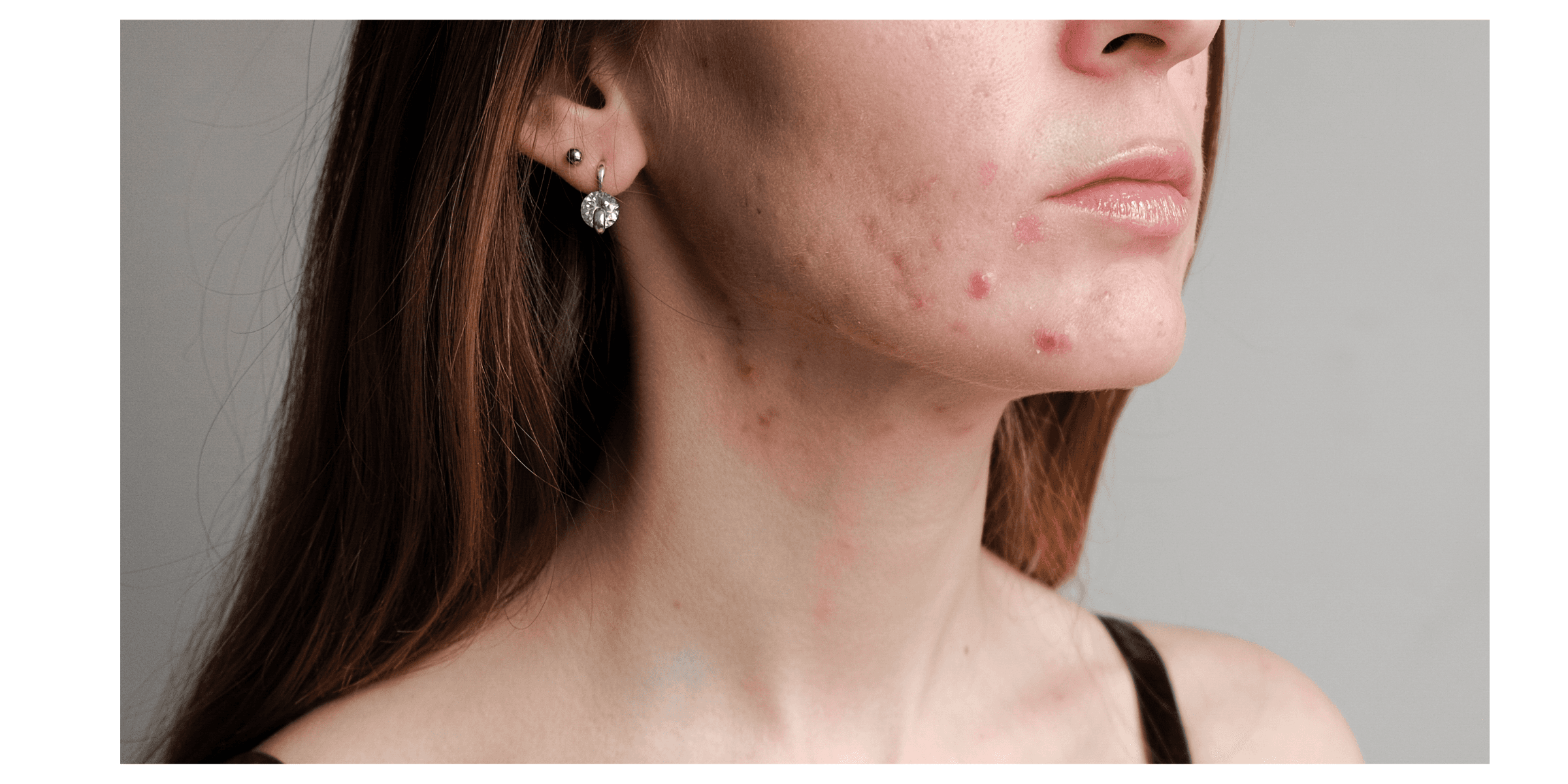 Afbeelding zonder ALT